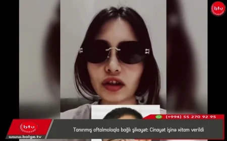 Tanınmış oftalmoloqla bağlı şikayət: Cinayət işinə xitam verildi