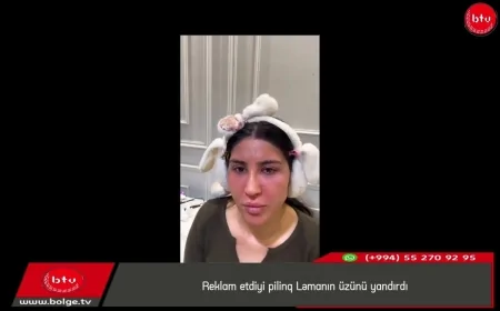 Reklam etdiyi pilinq Ləmanın üzünü yandırdı
